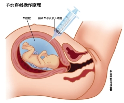 生活"毫无疑问,生物技术是继信息技术之后发展潜力和空间最大的,对